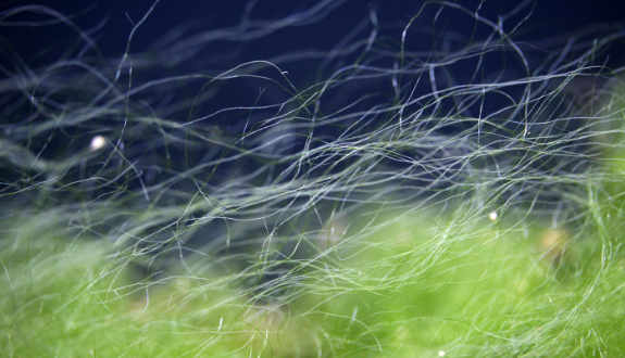 How to get rid of aquarium algae?